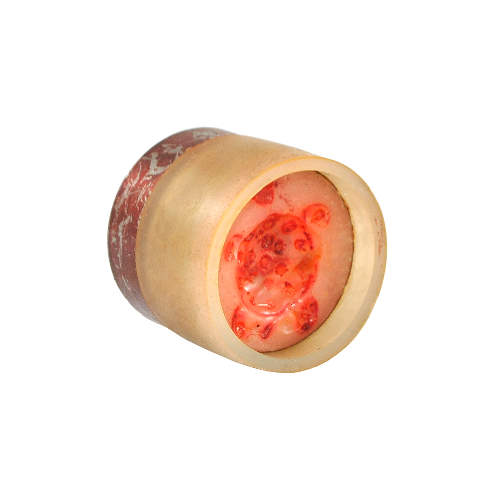 Матрица верх под пуговицу mt 155, шт. Матрицы под MT